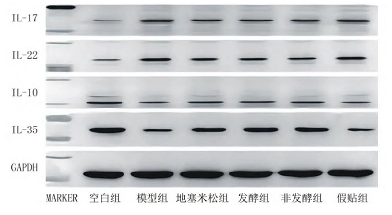 空白组和支气管哮喘各组大鼠肺组织中IL－17、IL－22、IL－10、IL－35蛋白表达电泳图